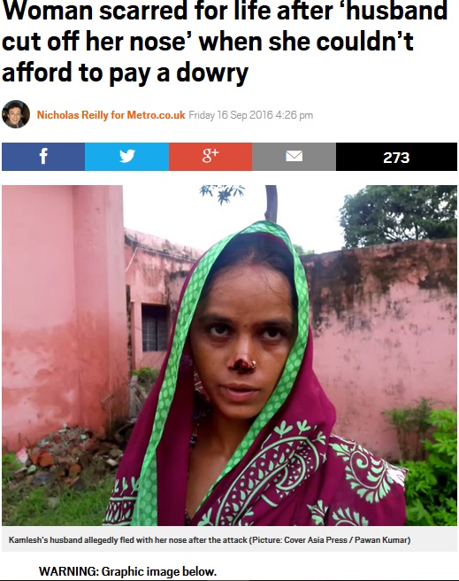 鼻を切り落とされたインドの女性（出典：http://metro.co.uk）