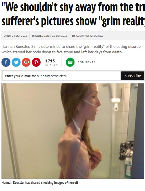 拒食症の現実を公開した女性（出典：http://www.mirror.co.uk）