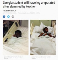 【海外発！Breaking News】激しい体罰で男子中学生の脚壊死、切断（米）