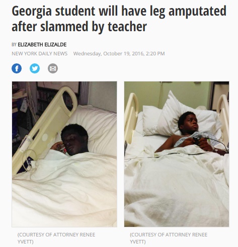 体罰の結果、男子生徒は脚切断。高額訴訟へ（出典：http://ktla.com）