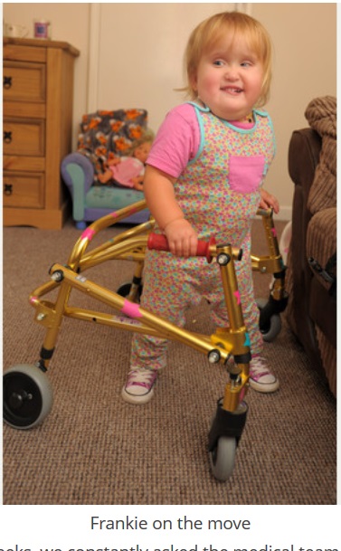 「一生車椅子の生活」と言われた女児、一歩を踏み出す（出典：www.plymouthherald.co.uk）