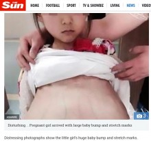 【海外発！Breaking News】「20歳の妻が妊娠したから」　病院に幼い少女を連れてきた40歳男が逮捕（中国）