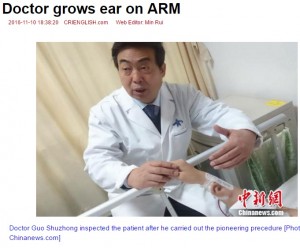 【海外発！Breaking News】交通事故で耳を失った男性　自分の腕で耳介を再建中（中国）