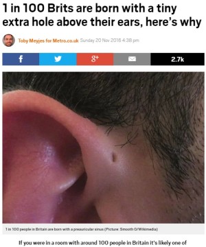 【海外発！Breaking News】英国人の100人に1人、日本人の50人に1人は耳の付け根に「小さな穴」がある！