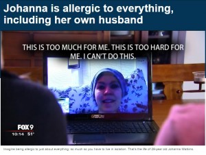 【海外発！Breaking News】「人間アレルギー」の女性　「愛する夫に触れることもできない」（米）