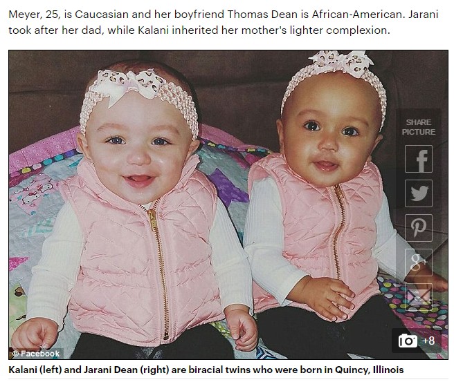 黒人と白人カップルから生まれた双子（出典：http://www.dailymail.co.uk）