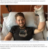 【海外発！Breaking News】アフガンで重傷を負った元海兵隊員　移植手術で新たな両腕を手に入れる　「夢はシェフになること」（米）