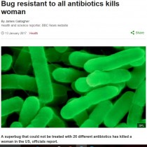 【海外発！Breaking News】26種の抗生物質に耐性を持つ「悪夢のスーパーバクテリア」　70歳女性が死亡（米）