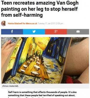 【海外発！Breaking News】「自傷行為を抑えるため」　18歳女性が脚に描いたゴッホの絵が素晴らしい（英）