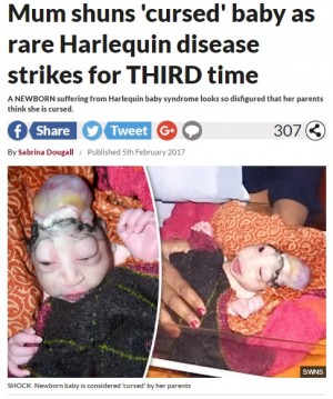 【海外発！Breaking News】奇病・ハーレクイン型魚鱗癬の赤ちゃん誕生も人々は「ヒンドゥーの神の化身」（印）