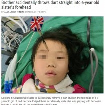 【海外発！Breaking News】7歳兄が投げたダーツが妹の眉間に突き刺さる（中国）【閲覧注意】