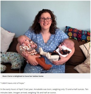 【海外発！Breaking News】400グラム台で産まれた“ミラクルベビー”の双子　もうすぐ10か月に（スコットランド）