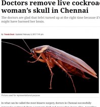 【海外発！Breaking News】女性の頭部から生きたゴキブリが！　死んでいたら脳にダメージも…（印）