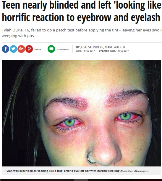 眉ティントで失明の危機にあった少女（出典：http://www.mirror.co.uk）