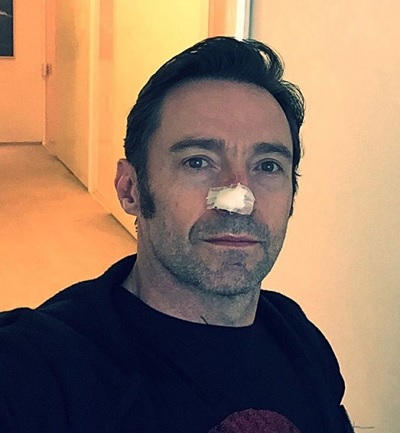 ヒュー・ジャックマン、皮膚がん再発を告白（出典：https://www.instagram.com/thehughjackman）