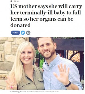 【海外発！Breaking News】無脳症の赤ちゃんを身ごもった母　臓器提供のため出産を決意（米）