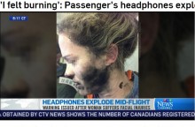 【海外発！Breaking News】機内でヘッドホンが爆発　豪・運輸安全局「リチウムイオン電池には気を付けて」