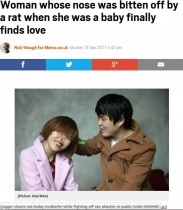 【海外発！Breaking News】ネズミに齧られ鼻を失った女性、いじめや離婚を乗り越え運命の相手に出会う（中国）