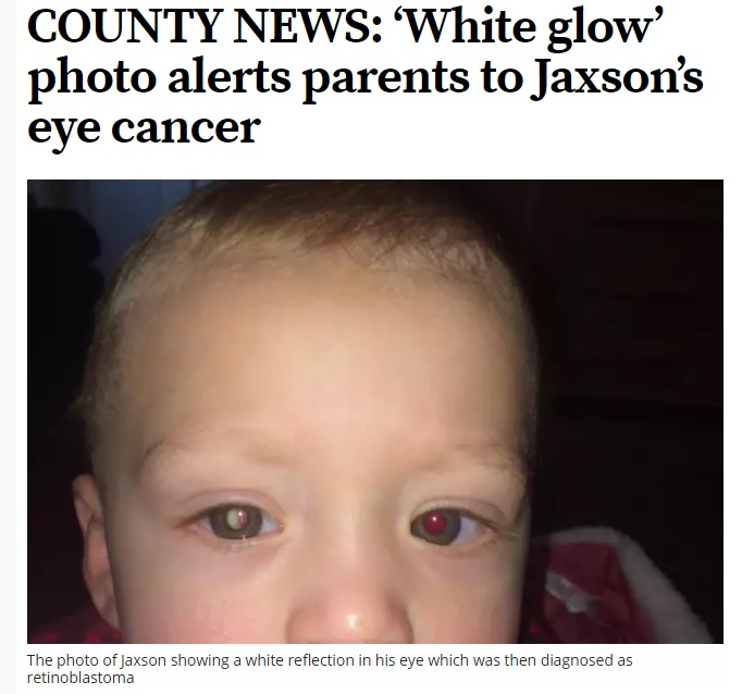 白く光る瞳はガンだった（出典：http://www.worthingherald.co.uk）