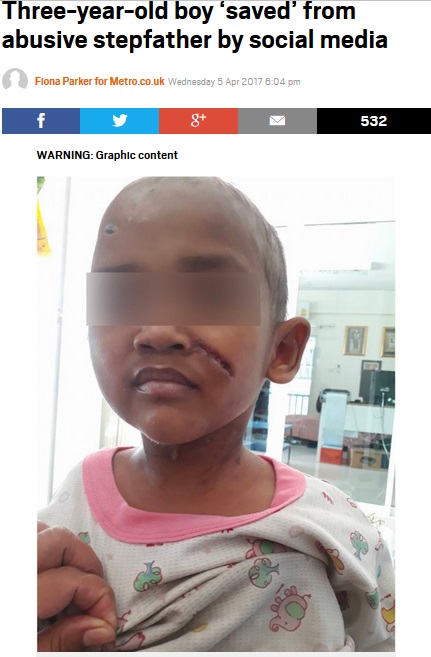 継父に虐待されていた3歳男児、頬には深い傷が（出典：http://metro.co.uk）