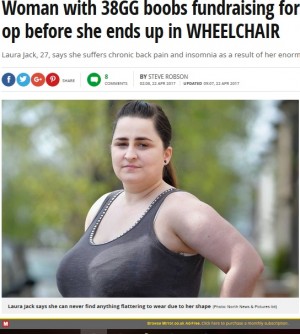 【海外発！Breaking News】「このままでは車椅子生活に…」爆乳の英女性、乳房縮小手術のため寄付を募る