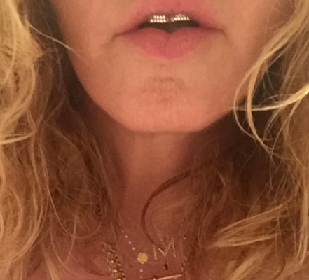 マドンナ、歯はゴールドでギラリ（出典：https://www.instagram.com/madonna）