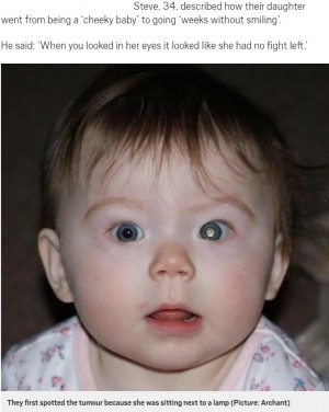 【海外発！Breaking News】ランプの光で異変を発見　生後8か月の娘の目に悪性腫瘍が！（英）