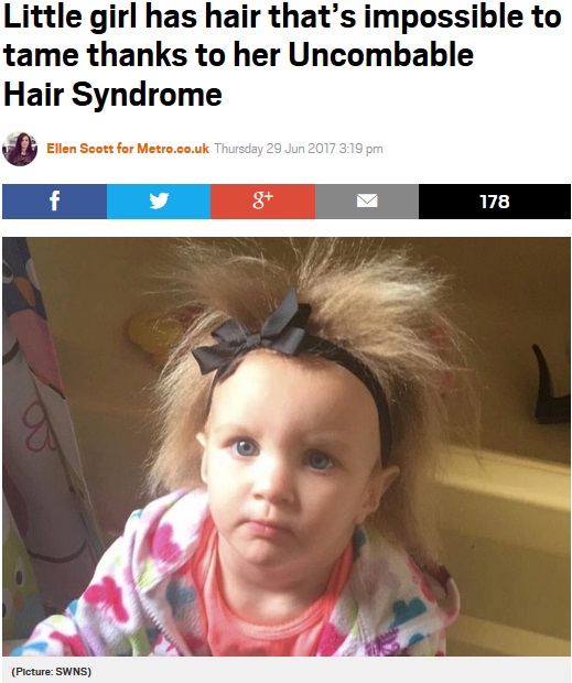 「櫛でとかせない頭髪症候群」の女児（画像は『Metro　2017年6月29日付「Little girl has hair that’s impossible to tame thanks to her Uncombable Hair Syndrome」（Picture: SWNS）』のスクリーンショット）