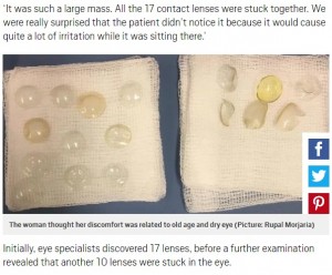 【海外発！Breaking News】眼球から27枚のコンタクトレンズが取り出された女性「不快感は歳のせいだと…」（英）