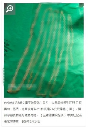 【海外発！Breaking News】刺身好きの少女の体内から260センチの寄生虫を摘出（台湾）