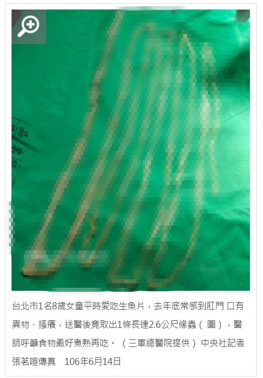 摘出された寄生虫（画像は『中央社即時新聞　2017年6月14日付「愛吃生魚片 女童肛門取出2公尺活蟲」（三軍總醫院提供/中央社記者張茗喧傳真）』のスクリーンショット　画像を一部加工しています）