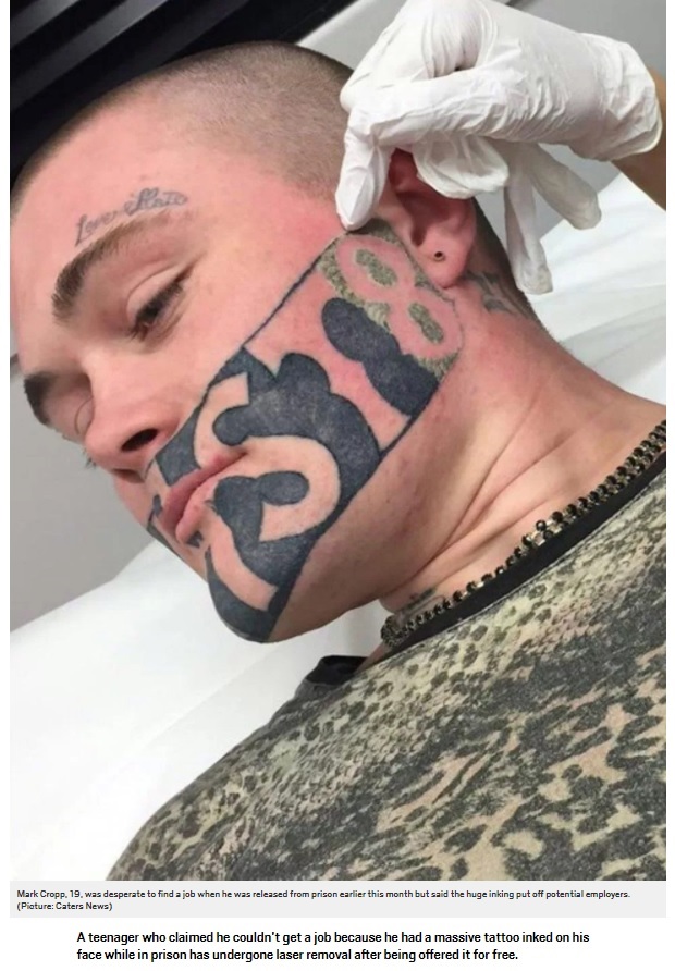 タトゥー除去へ（画像は『Metro　2017年7月18日付「Man gets DEVAST8 tattoo removed for free because it stopped him getting job」（Picture: Caters News）』のスクリーンショット）