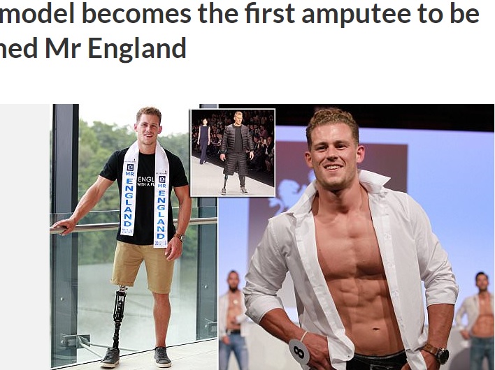 片脚の男性モデル「ミスター・イングランド」に決定（画像は『cetusnews　2017年7月17日付「Male model becomes the first amputee to be crowned Mr England」』のスクリーンショット）