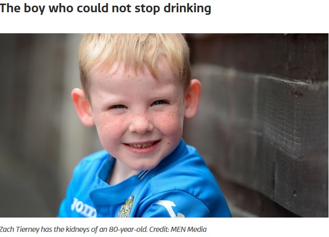 腎臓機能が80歳超レベルと宣告された6歳児（画像は『ITV　2017年7月31日付「The boy who could not stop drinking」（Credit: MEN Media）』のスクリーンショット）