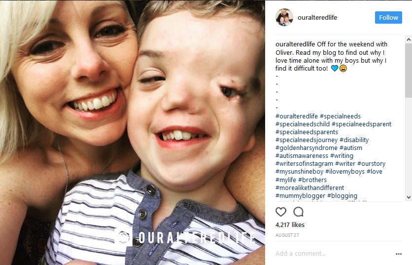 息子の写真をインスタ側に削除された母が激怒（画像は『Our Altered Life　2017年8月27日付Instagram「Off for the weekend with Oliver.」』のスクリーンショット）