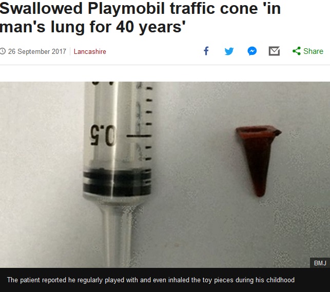 40年ぶりに摘出されたのは小さな玩具！（画像は『BBC News　2017年9月26日付「Swallowed Playmobil traffic cone ‘in man's lung for 40 years’」（BMJ）』のスクリーンショット）