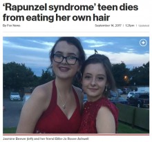 【海外発！Breaking News】恐ろしい食毛癖　腹膜炎で急死した16歳少女の胃からボール状の毛髪（英）