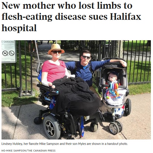 四肢切断と子宮摘出を余儀なくされた女性（画像は『The Globe and Mail　2017年10月11日付「New mother who lost limbs to flesh-eating disease sues Halifax hospital」（HO-MIKE SAMPSON/THE CANADIAN PRESS）』のスクリーンショット）
