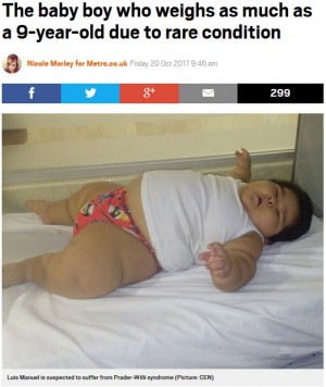 【海外発！Breaking News】生後10か月の男の子　過度の体重増加が止まらず30kgに（メキシコ）