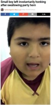 【海外発！Breaking News】笛を誤飲した男児　医師が術前の動画を公開（アルゼンチン）＜動画あり＞
