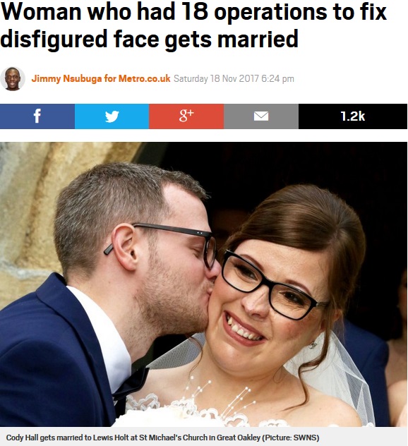 顔面奇形で生まれ多くの手術を経験した女性、最愛の彼とゴールイン（画像は『Metro　2017年11月18日付「Woman who had 18 operations to fix disfigured face gets married」（Picture: SWNS）』のスクリーンショット）