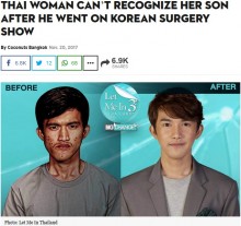 【海外発！Breaking News】顔の歪みを持つ男性が整形で大変身　母親は息子と気付かず（タイ）＜動画あり＞