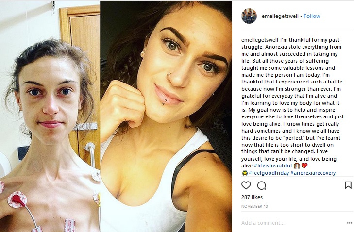 拒食症を克服した女性、自らビフォー＆アフターを公開（画像は『Emelle Lewis　2017年11月10日付Instagram「I’m thankful for my past struggle.」』のスクリーンショット）