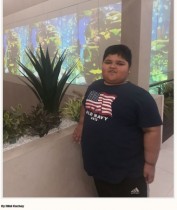 【海外発！Breaking News】7歳で体重120kg　パキスタンの男児、胃切除手術で減量にチャレンジ