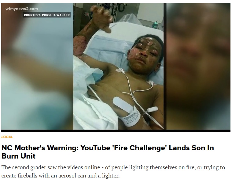 7歳少年ネットで流行の「ファイアー・チャレンジ」で大やけど（画像は『WKYC.com　2017年12月2日付「NC Mother’s Warning: YouTube ‘Fire Challenge’ Lands Son In Burn Unit」』のスクリーンショット）