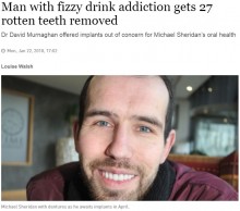【海外発！Breaking News】炭酸飲料の飲みすぎで虫歯だらけになった男性、笑顔を取り戻す（アイルランド）