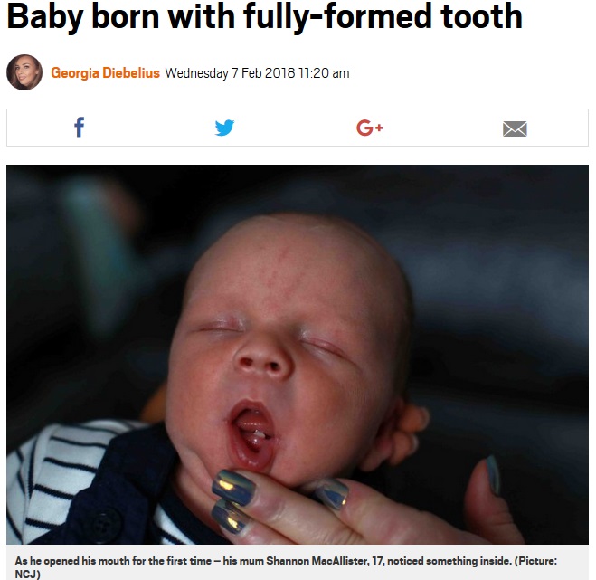 誕生した赤ちゃんに、すでに前歯が（画像は『Metro　2018年2月7日付「Baby born with fully-formed tooth」（Picture: NCJ）』のスクリーンショット）