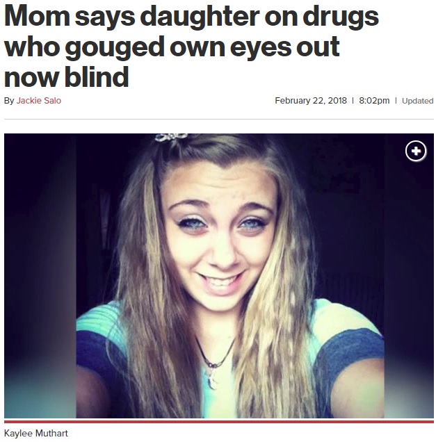 薬物依存で精神錯乱を起こした女性（画像は『New York Post　2018年2月22日付「Mom says daughter on drugs who gouged own eyes out now blind」（Facebook）』のスクリーンショット）