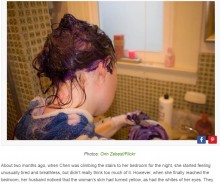 【海外発！Breaking News】毎月の染髪を10年間続けた女性、慢性肝障害に（中国）