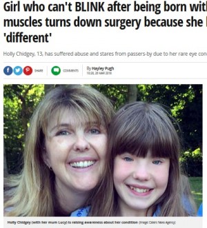 【海外発！Breaking News】瞼の筋肉を持たずに生まれた13歳少女　「人と異なるところが好きだから」と手術を拒否（英）